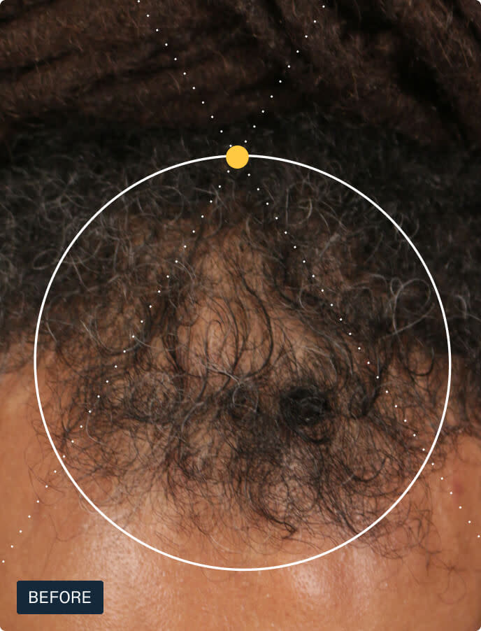 Men's Hair Growth Pack