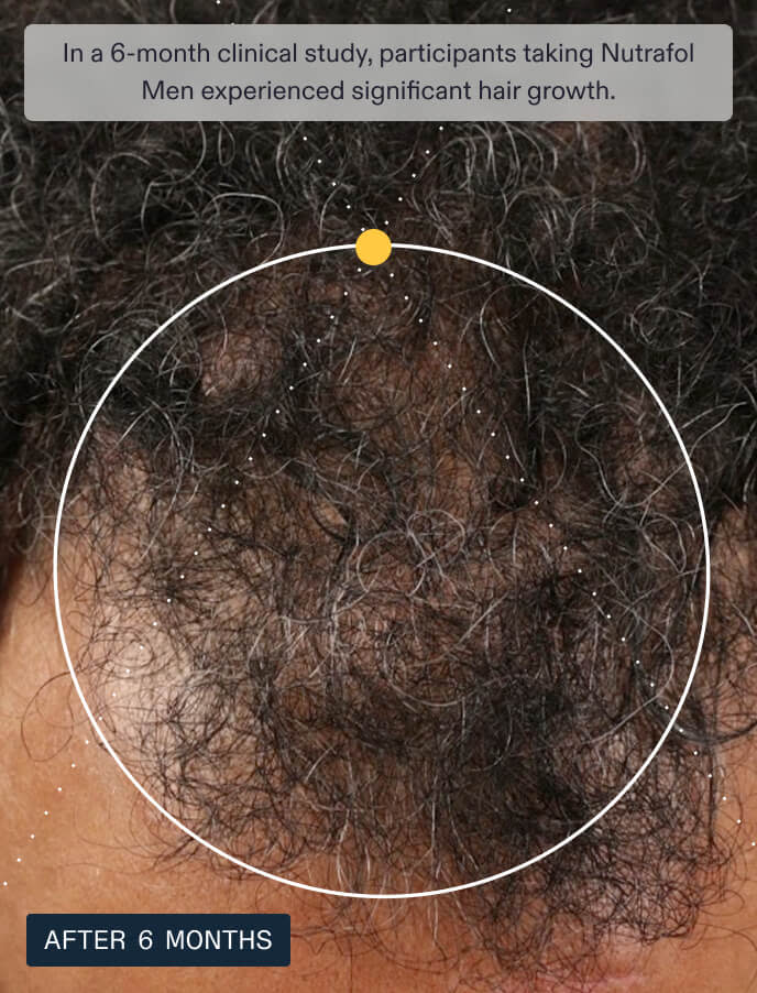 Men's Hair Growth Pack