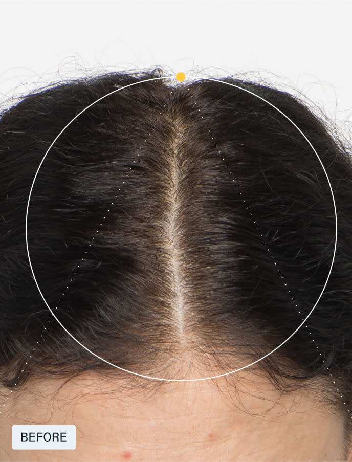 Women’s Hair Growth Pack